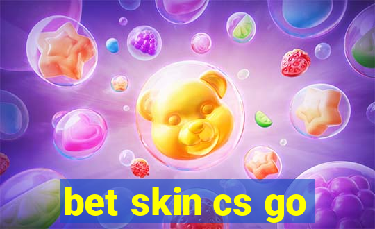 bet skin cs go