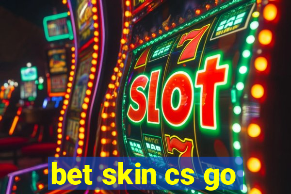 bet skin cs go