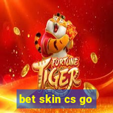 bet skin cs go