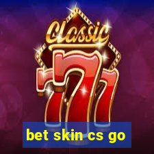 bet skin cs go