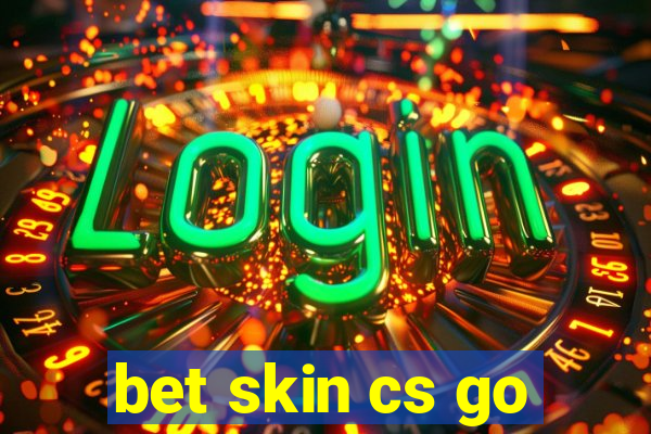 bet skin cs go