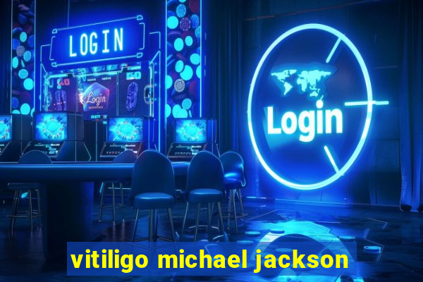 vitiligo michael jackson